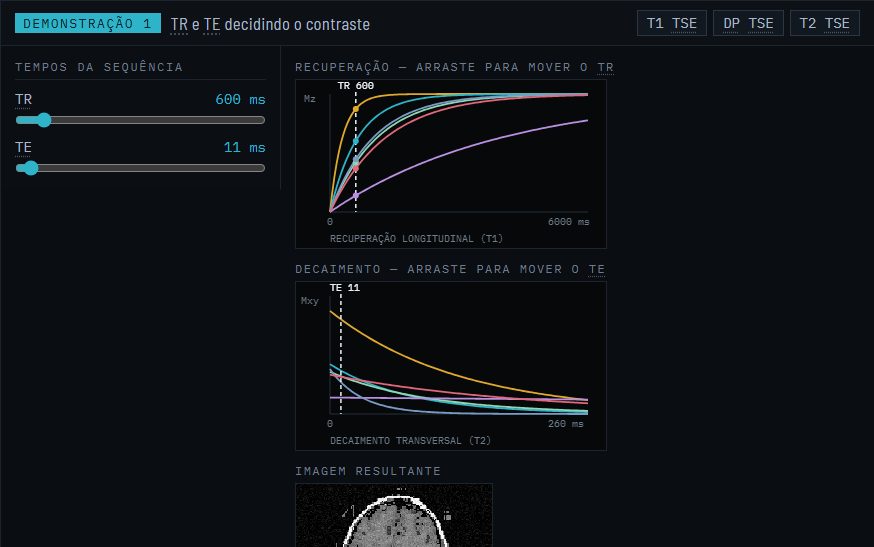Review demonstration: recovery and decay curves with TR and TE